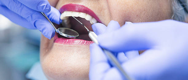 Best Broken or Chipped Tooth Repair in Chardon, OH